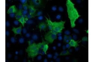 Immunofluorescence (IF) image for anti-Protein Kinase, CAMP-Dependent, Regulatory, Type I, beta (PRKAR1B) antibody (ABIN1500409) (PRKAR1B anticorps)