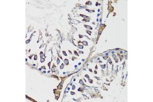 Immunohistochemistry of paraffin-embedded rat testis using Cyclin B1 antibody (ABIN7266555) at dilution of 1:100 (40x lens). (Cyclin B1 anticorps  (C-Term))