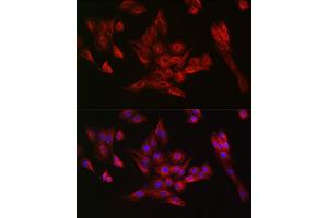 Immunofluorescence analysis of PC-12 cells using α-Tubulin Rabbit mAb (ABIN7271036) at dilution of 1:100 (40x lens).