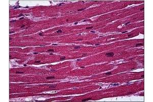 Immunohistochemistry (IHC) image for anti-B-Cell CLL/lymphoma 11A (Zinc Finger Protein) (BCL11A) (AA 1-89) antibody (ABIN782364)