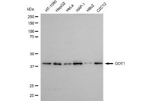 Western blotting analysis using GOT1 antibody (ABIN7798745).