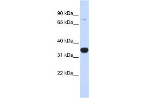 WB Suggested Anti-RHOT1 Antibody Titration:  0. (RHOT1 anticorps  (N-Term))