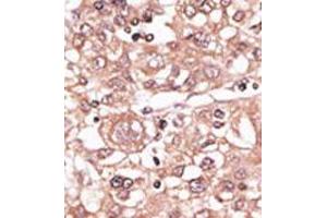 Image no. 2 for anti-Toll-Like Receptor 7 (TLR7) (N-Term) antibody (ABIN357057) (TLR7 anticorps  (N-Term))