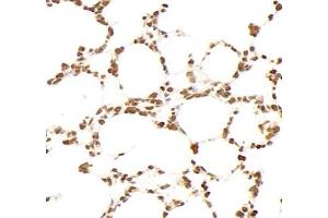 Immunohistochemistry analysis of paraffin-embedded rat lung using,GSTT1 (ABIN7074091) at dilution of 1: 2000