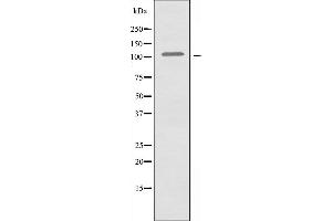 Western blot analysis of extracts from COLO205 cells using AF10 antibody. (MLLT10 anticorps  (Internal Region))