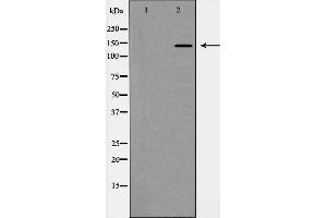 Western blot analysis of PDGFR α expression in HepG2 cells. (PDGFRA anticorps  (C-Term))