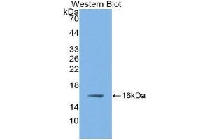 Detection of Recombinant NOS1, Rat using Polyclonal Antibody to Nitric Oxide Synthase 1, Neuronal (NOS1) (NOS1 anticorps  (AA 9-136))