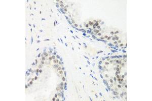 Immunohistochemistry of paraffin-embedded human prostate using PPAN antibody at dilution of 1:200 (40x lens). (PPAN anticorps)