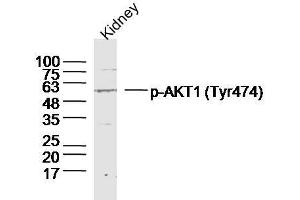 Mouse kidney lysates probed with AKT1/2/3 (Tyr474) Polyclonal Antibody, unconjugated  at 1:300 overnight at 4°C followed by a conjugated secondary antibody at 1:10000 for 90 minutes at 37°C. (AKT 1/2/3 anticorps  (pTyr474))