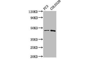 Western Blot Positive WB detected in: PC-3 whole cell lysate, Colo320 whole cell lysate All lanes: CAPS2 antibody at 5. (Calcyphosine 2 anticorps  (AA 191-274))