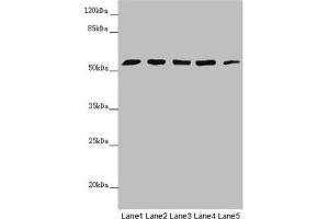 Western blot All lanes: CEP57L1 antibody at 6. (CEP57L1 anticorps  (AA 1-167))