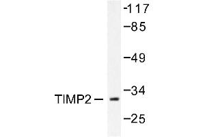 Image no. 1 for anti-Metalloproteinase Inhibitor 2 (TIMP2) antibody (ABIN271854) (TIMP2 anticorps)
