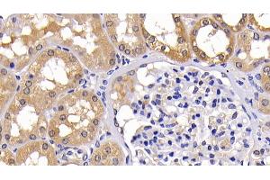 Detection of Bcl2L in Human Kidney Tissue using Polyclonal Antibody to B-Cell CLL/Lymphoma 2 Like Protein (Bcl2L)