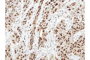 IHC-P Image Immunohistochemical analysis of paraffin-embedded TW2.