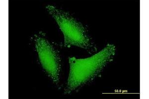 Immunofluorescence of purified MaxPab antibody to DCP2 on HepG2 cell.