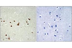 Immunohistochemistry analysis of paraffin-embedded human brain, using ANKRD26 Antibody. (ANKRD26 anticorps  (AA 791-840))