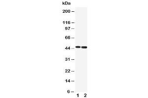 Western blot testing of 5HT1A Receptor antibody and Lane 1:  rat brain (Serotonin Receptor 1A anticorps  (C-Term))