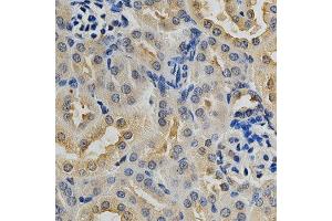 Immunohistochemistry of paraffin-embedded mouse kidney using MAPK10 antibody at dilution of 1:200 (x400 lens) (MAPK10 anticorps)