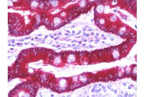 Anti-SLC35D2 antibody IHC staining of human small intestine.