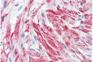 Human Prostate, Stroma: Formalin-Fixed, Paraffin-Embedded (FFPE) (beta Actin anticorps  (AA 1-376))