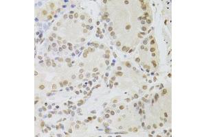 Immunohistochemistry of paraffin-embedded human stomach using RUVBL1 Antibody. (RUVBL1 anticorps  (AA 1-240))