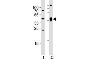 Western blot analysis of (1) zebrafish brain and (2) whole zebrafish tissue lysate using Ada antibody. (ADA anticorps  (AA 114-148))