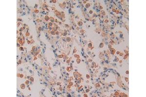 Used in DAB staining on fromalin fixed paraffin- embedded Kidney tissue (PSMD5 anticorps  (AA 143-341))