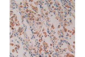 Used in DAB staining on fromalin fixed paraffin- embedded Kidney tissue (Proteasome 26S Subunit, Non ATPase 5 (AA 143-341) anticorps)
