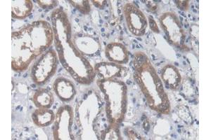 DAB staining on IHC-P; Samples: Human Kidney Tissue) (GOT1 anticorps  (AA 1-413))