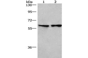 Western Blot analysis of Lovo cell and Mouse lung tissue using CD244 Polyclonal Antibody at dilution of 1:526 (2B4 anticorps)