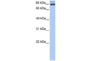 Western Blot showing PCK1 antibody used at a concentration of 1-2 ug/ml to detect its target protein. (PCK1 anticorps  (Soluble))