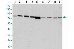 Western blot analysis using ADRBK1 monoclonal antibody, clone 3F8  against HeLa (1), Jurkat (2), MOLT 4 (3), Raji (4), THP-1 (5), L1210 (6), COS-7 (7), PC-12 (8), and NIH/3T3 (9) cell lysate.