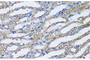 Immunohistochemistry of paraffin-embedded Mouse kidney using NQO2 Polyclonal Antibody at dilution of 1:100 (40x lens).
