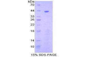 SDS-PAGE analysis of Human C8b Protein. (C8B Protéine)