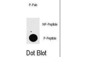 Dot Blot (DB) image for anti-TGF-beta Activated Kinase 1/MAP3K7 Binding Protein 1 (TAB1) (pSer423) antibody (ABIN5021453) (TAB1 anticorps  (pSer423))