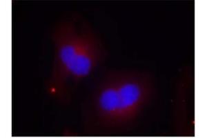 Image no. 2 for anti-PTK2 Protein tyrosine Kinase 2 (PTK2) (pTyr925) antibody (ABIN196824) (FAK anticorps  (pTyr925))