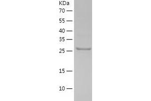 Western Blotting (WB) image for Pyridoxal (Pyridoxine, Vitamin B6) Phosphatase (PDXP) (AA 1-292) protein (His-IF2DI Tag) (ABIN7124712)
