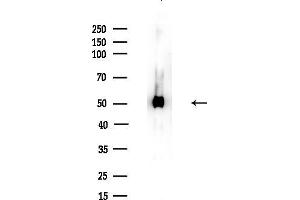 Western blot analysis of lysates from Mouse brain, using EIF5 Antibody at 1/1000 dilution.