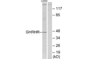 Western blot analysis of extracts from LOVO cells, using GHRHR antibody. (GHRHR anticorps  (C-Term))