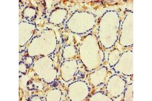 Immunohistochemistry of paraffin-embedded human thyroid tissue using ABIN7161000 at dilution of 1:100 (ME3 anticorps  (AA 547-598))