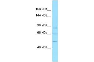 Western Blotting (WB) image for anti-GTF2I Repeat Domain Containing 2 (GTF2IRD2) (C-Term) antibody (ABIN2789098) (GTF2IRD2 anticorps  (C-Term))