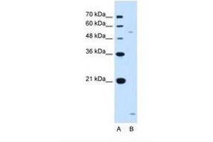 Image no. 2 for anti-ST3 beta-Galactoside alpha-2,3-Sialyltransferase 5 (ST3GAL5) (AA 151-200) antibody (ABIN321105) (ST3GAL5 anticorps  (AA 151-200))
