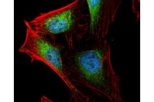 ICC/IF Image Arp2 antibody [N1C3] detects Arp2 protein at cytoplasm by immunofluorescent analysis. (ACTR2 anticorps)