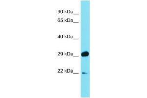 Host: Rabbit Target Name: PGAM1 Sample Type: Fetal Brain lysates Antibody Dilution: 1. (PGAM1 anticorps  (C-Term))
