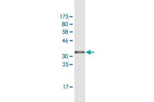 Western Blot detection against Immunogen (37.