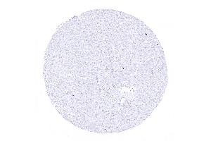 Liver The liver represents an ideal normal tissue control for Ki 67 staining quality.