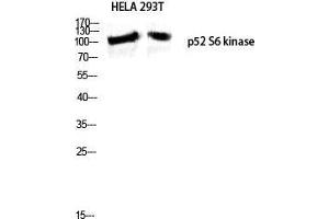 Western Blot (WB) analysis of HeLa 293T lysis using p52 S6 kinase antibody. (RPS6KC1 anticorps  (Internal Region))