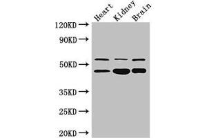 Western Blot Positive WB detected in: Mouse heart tissue, , Mouse kidney tissue, Mouse brain tissue All lanes: HNF4A antibody at 3 μg/mL Secondary Goat polyclonal to rabbit IgG at 1/50000 dilution Predicted band size: 53, 52, 47, 57, 51, 49, 44 kDa Observed band size: 53, 47 kDa (HNF4A anticorps  (AA 130-330))