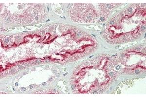 Detection of FOLR1 in Human Kidney Tissue using Polyclonal Antibody to Folate Receptor 1, Adult (FOLR1)
