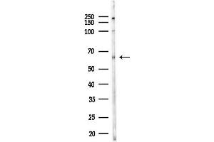 anti-Frizzled Family Receptor 10 (FZD10) antibody